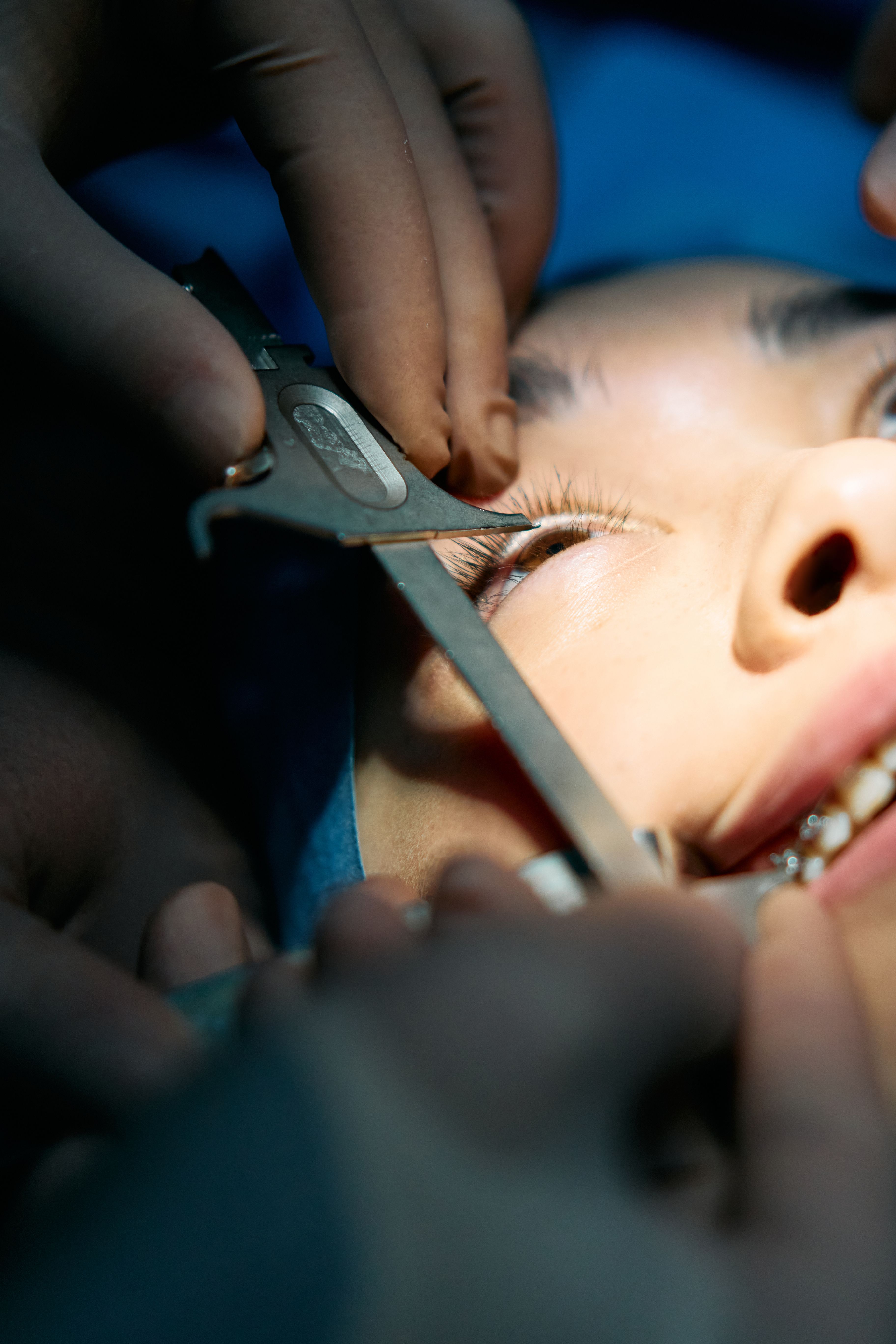 Eyes treatment case 2