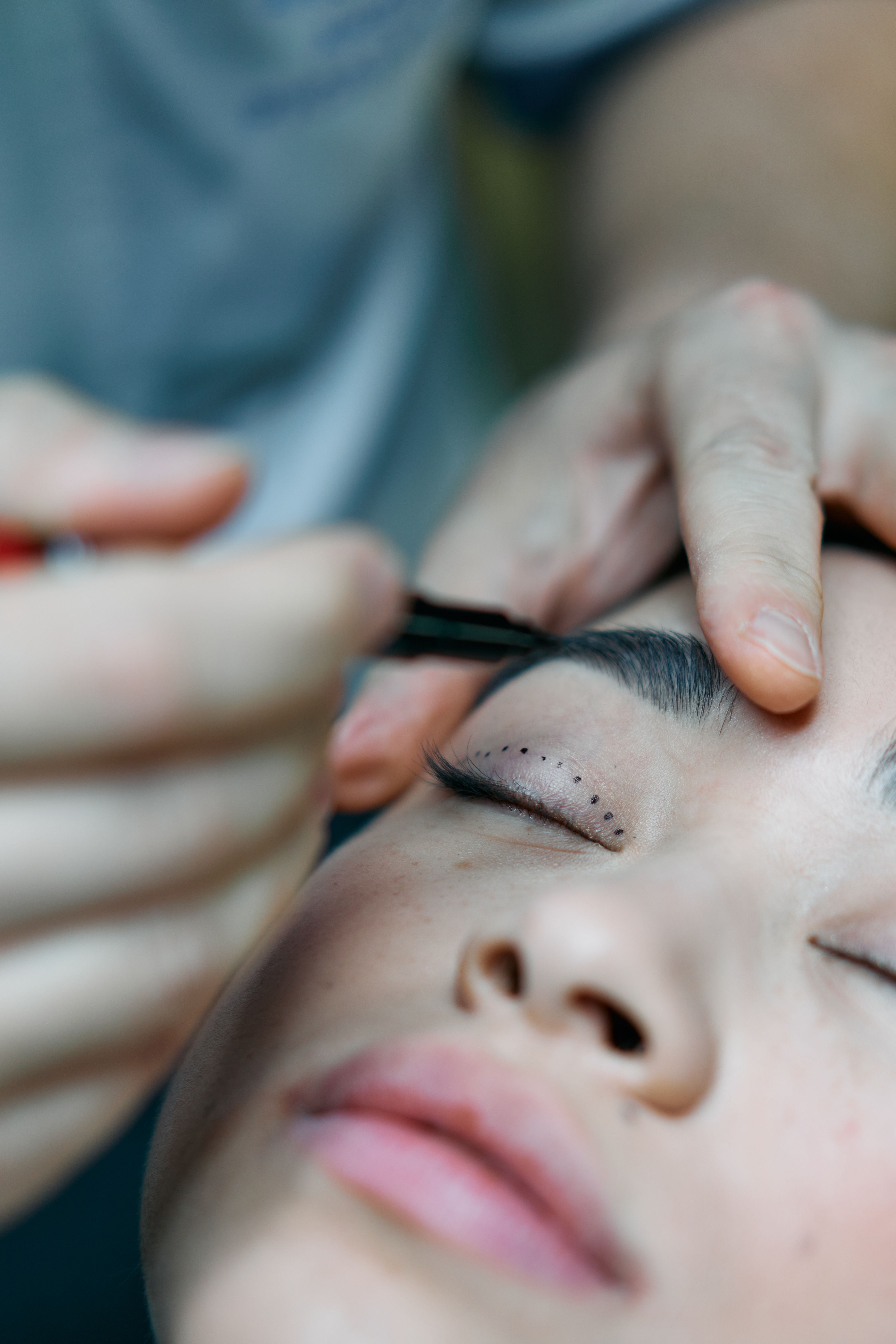 Eyes treatment case 3