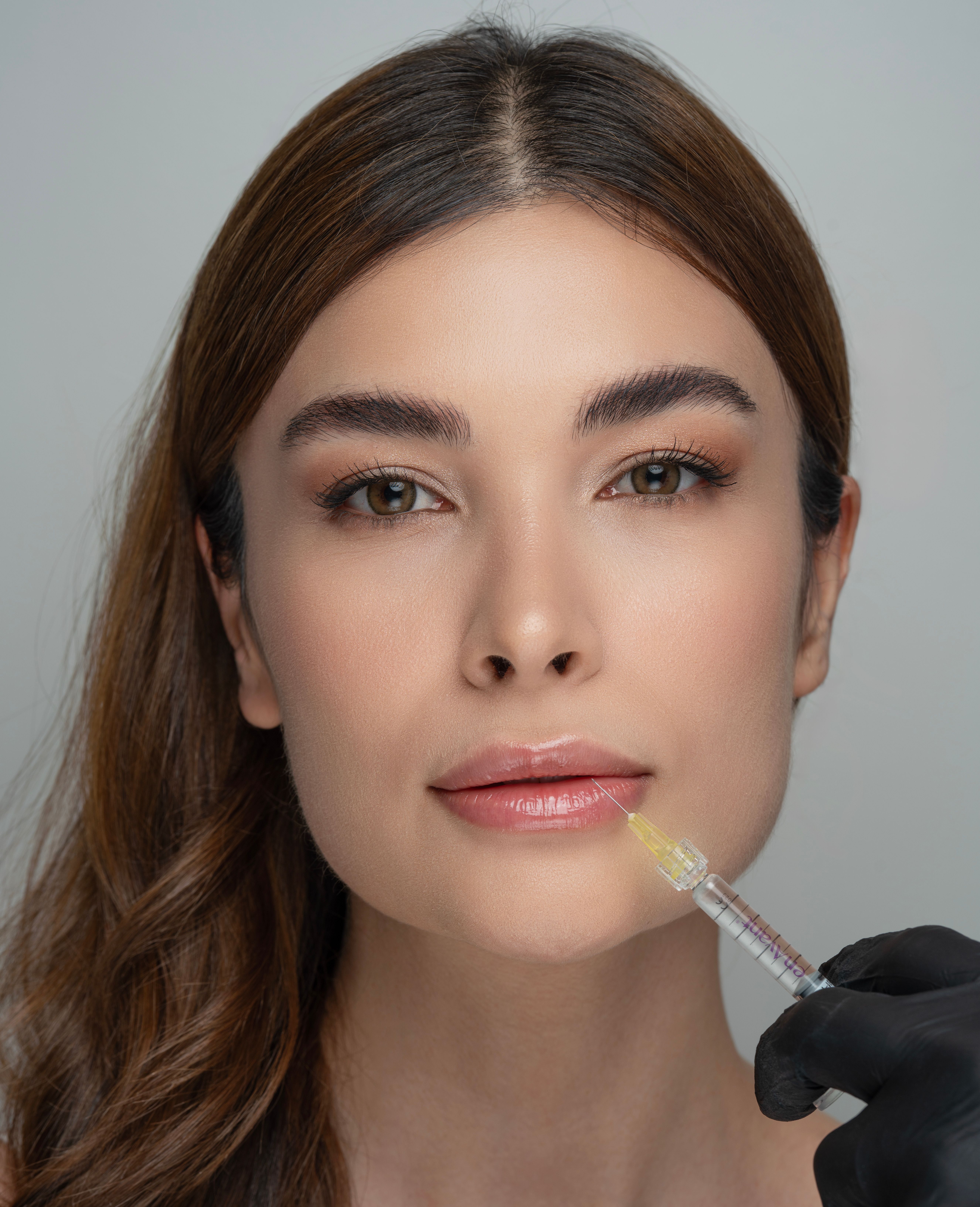 Lips treatment case 2