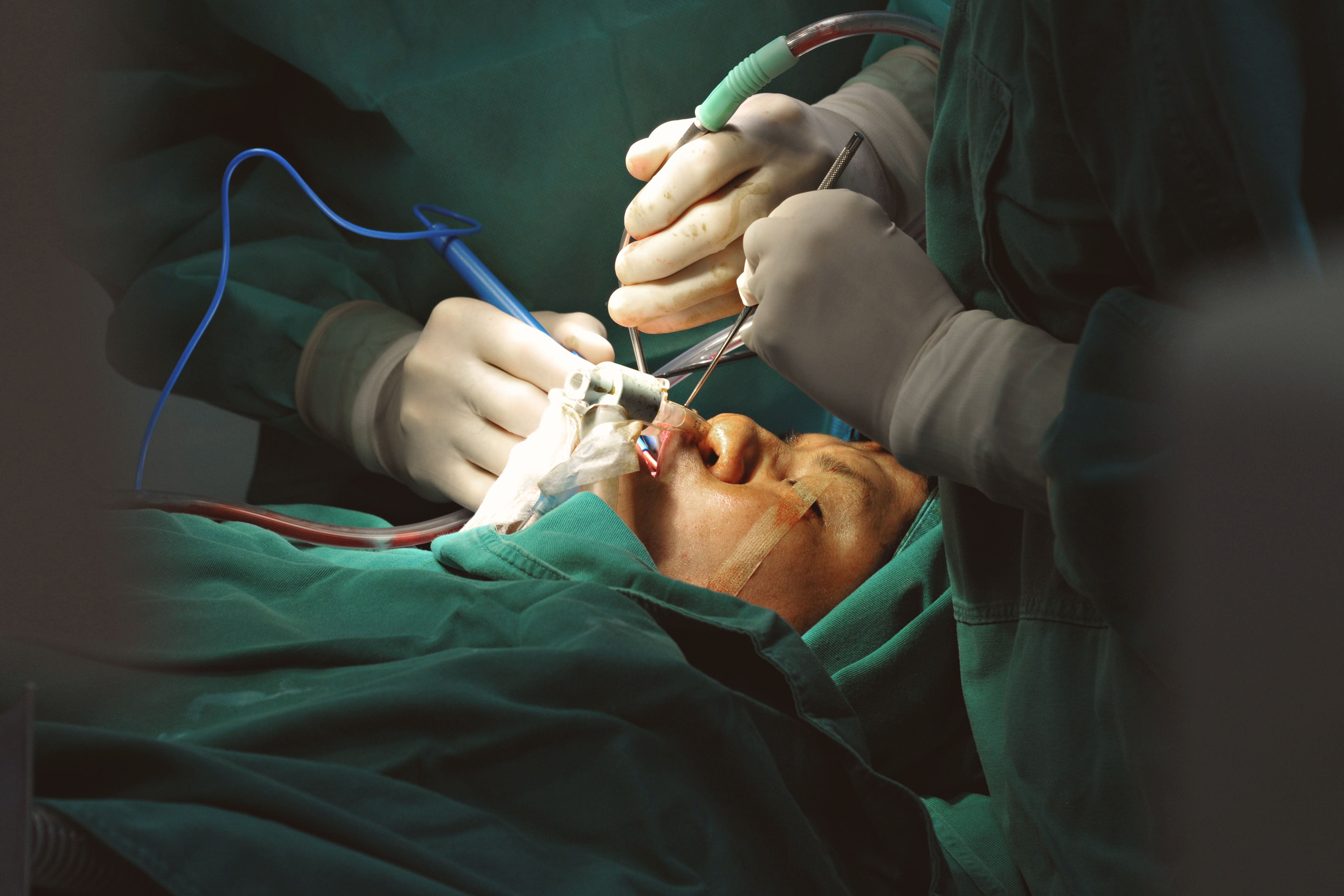 Nose treatment case 3